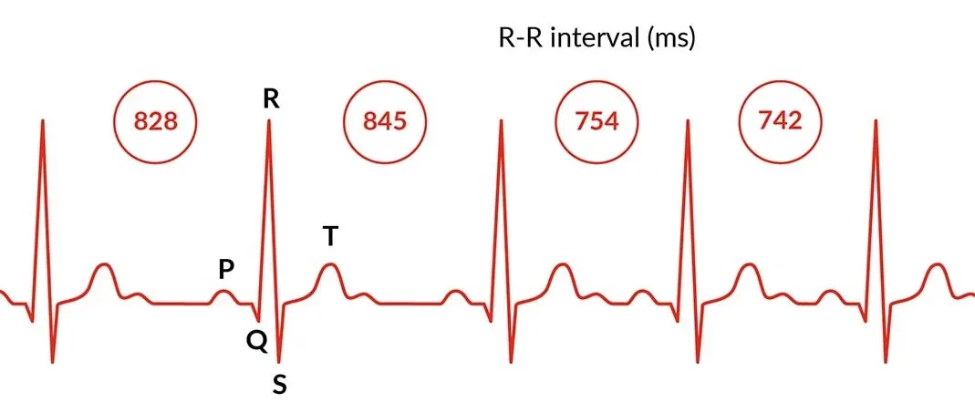 Understanding Garmin HRV: A Comprehensive Guide to Heart Rate Variability
